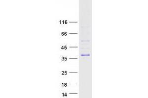 Validation with Western Blot (TIRAP Protein (Transcript Variant 3) (Myc-DYKDDDDK Tag))