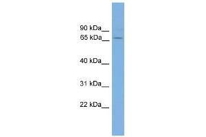 WB Suggested Anti-GAD1 Antibody Titration: 0. (GAD anticorps  (N-Term))