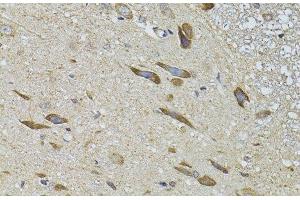 Immunohistochemistry of paraffin-embedded Rat spinal cord using ADRBK2 Polyclonal Antibody at dilution of 1:100 (40x lens). (ADRBK2 anticorps)