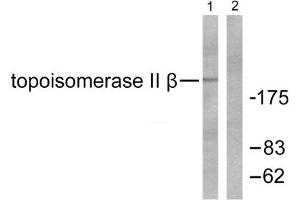 Western blot analysis of extracts from Jurkat cells, using Topoisomerase II beta antibody. (TOP2B anticorps  (N-Term))