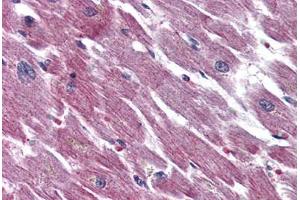 Anti-ADCYAP1R1 antibody  ABIN1048297 IHC staining of human heart.