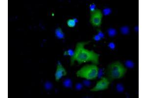 Image no. 4 for anti-Acetyl-CoA Acetyltransferase 2 (ACAT2) antibody (ABIN1496397) (ACAT2 anticorps)