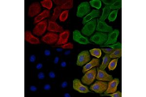 ABIN7093304 and ABIN7097323 staining H2O2 treated Hela cells by IF/ICC.