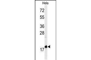 Western blot analysis of MMGT1 Antibody in Hela cell line lysates (35ug/lane) (MMGT1 anticorps  (C-Term))