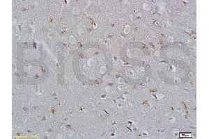 Formalin-fixed and paraffin embedded rat brain tissue labeled with Rabbit Anti-EpCAM/CD326 Polyclonal Antibody (ABIN670611), Unconjugated at 1:200 followed by conjugation to the secondary antibody and DAB staining. (EpCAM anticorps  (AA 53-150))