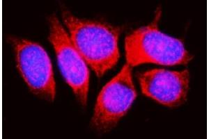 IF analysis of RPL11 using anti-RPL11 antibody (ABIN7602315). (RPL11 anticorps  (AA 7-178))
