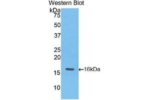 Western Blotting (WB) image for anti-Fast Skeletal Troponin T3a (TNNT3A) (AA 147-269) antibody (ABIN1176067) (TNNT3A anticorps  (AA 147-269))