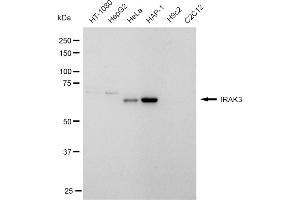 Western blotting analysis using IRAK3 antibody (ABIN7799115).