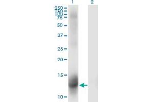 Western Blot analysis of NR3C2 expression in transfected 293T cell line by NR3C2 monoclonal antibody (M01), clone 2B5. (NR3C2 anticorps  (AA 1-110))
