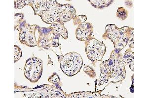 IHC analysis of NMI using anti-NMI antibody (ABIN6719489).
