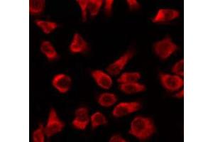 ABIN6266987 staining sw480 by IF/ICC. (KRT16 anticorps  (N-Term))