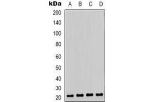 Western blot analysis of HP1 gamma (pS93) expression in Jurkat (A), K562 (B), A431 (C), Raw264. (CBX3 anticorps  (pSer93))