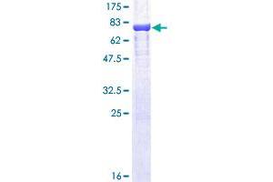 Image no. 1 for Ornithine Decarboxylase 1 (ODC1) (AA 1-461) protein (GST tag) (ABIN1313332)