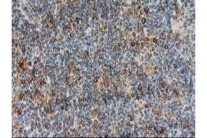 Image no. 1 for anti-Protein tyrosine Phosphatase, Non-Receptor Type 1 (PTPN1) antibody (ABIN1500496)