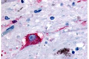 Anti-NPBWR2 antibody  ABIN1049112 IHC staining of human brain, neurons and glia. (NPBWR2 anticorps  (N-Term))