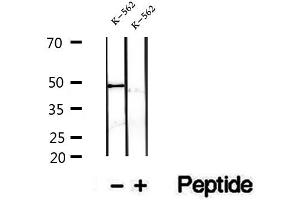 Western blot analysis of extracts of K-562 cells, using FECH antibody.