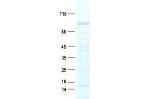 Validation with Western Blot (EEF1D Protein (His tag))