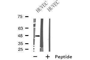 Western blot analysis of extracts from HUVEC cells, using BRS3 antibody.