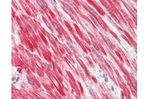 Anti-MYOD / MYOD1 antibody IHC staining of human small intestine, muscularis propria.