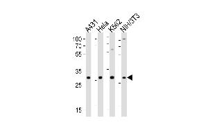Western blot analysis of lysates from A431, Hela, K562, mouse NIH/3T3 cell line (from left to right), using CDK5 Antibody (C-term) (ABIN6242783 and ABIN6577637). (CDK5 anticorps  (C-Term))