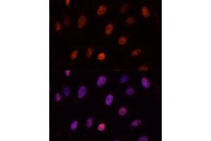 Immunofluorescence analysis of U-2OS cells using PCGF1 antibody (ABIN6129080, ABIN6145307, ABIN6145308 and ABIN6221952) at dilution of 1:100. (PCGF1 anticorps  (AA 20-259))