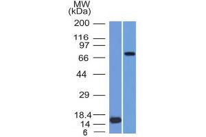 Western Blot of (1) Recombinant MMP2 protein and (2) U87 cell lysate using MMP2 Monoclonal Antibody (MMP2/1501). (MMP2 anticorps  (AA 444-575))