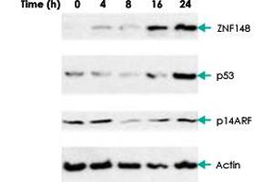 Western blot analysis of AGS (gastric carcinoma) cells with ZNF148 polyclonal antibody .