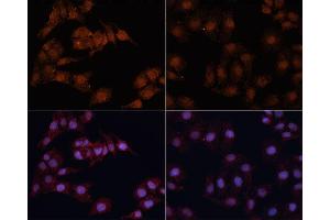 Immunofluorescence analysis of HeLa cells using MAP1LC3B antibody.