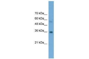 GALE antibody used at 0.