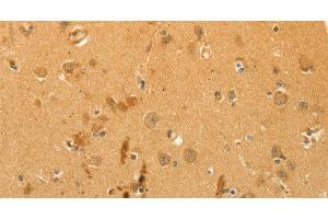 Immunohistochemistry of paraffin-embedded Human brain using CFHR1 Polyclonal Antibody at dilution of 1:40