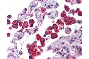 Anti-NLRP13 antibody IHC of human lung.