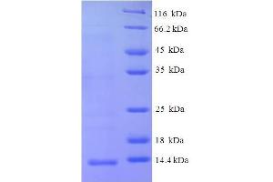 Chemokine (C-X-C Motif) Ligand 10 (CXCL10) (AA 22-98) protein (His tag) expressed in E.