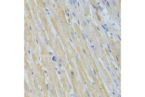 Immunohistochemistry of paraffin-embedded rat heart using NME1 Antibody (ABIN5970089) at dilution of 1/200 (40x lens). (NME1 anticorps  (C-Term))