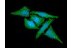 ICC/IF analysis of MAT2A in HeLa cells line, stained with DAPI (Blue) for nucleus staining and monoclonal anti-human MAT2A antibody (1:100) with goat anti-mouse IgG-Alexa fluor 488 conjugate (Green). (MAT2A anticorps)