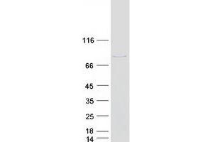 Validation with Western Blot