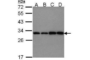 WB Image Sample (30 ug of whole cell lysate) A: 293T B: A431 , C: JurKat D: Raji 12% SDS PAGE antibody diluted at 1:1000 (PGAM1 anticorps)