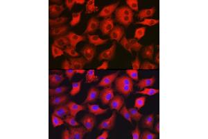 Immunofluorescence analysis of  cells using GAMT Rabbit pAb (ABIN6130447, ABIN6140950, ABIN6140951 and ABIN6222280) at dilution of 1:200 (40x lens).