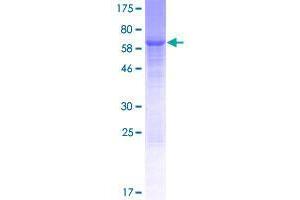 Image no. 1 for WD Repeat Domain 73 (WDR73) (AA 1-378) protein (GST tag) (ABIN1325272)