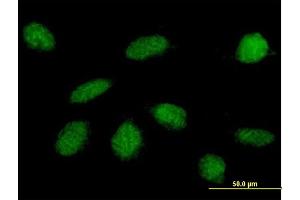 Immunofluorescence of purified MaxPab antibody to GLI4 on HeLa cell. (GLI4 anticorps  (AA 1-376))