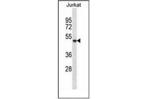 Western blot analysis of NBPF5 Antibody (C-term) in Jurkat cell line lysates (35ug/lane). (NBPF5 anticorps  (C-Term))