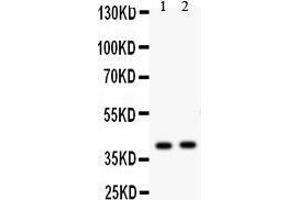 Anti- NDRG2 antibody, Western blotting All lanes: Anti NDRG2  at 0. (NDRG2 anticorps  (C-Term))