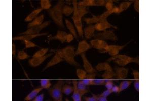 Immunofluorescence analysis of HeLa cells using UGT2B7 Polyclonal Antibody at dilution of 1:100 (40x lens).