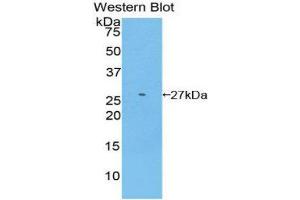 Western Blotting (WB) image for anti-Glutathione S-Transferase mu 2 (Muscle) (GSTM2) (AA 5-202) antibody (ABIN1859092) (GSTM2 anticorps  (AA 5-202))