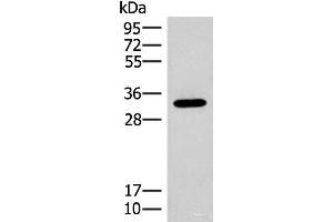 Western blot analysis of Mouse liver tissue lysate using RGR Polyclonal Antibody at dilution of 1:300 (RGR anticorps)