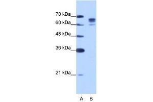 DDX17 antibody used at 1. (DDX17 anticorps)