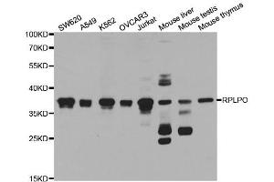 Western Blotting (WB) image for anti-Ribosomal Protein, Large, P0 (RPLP0) antibody (ABIN1876737) (RPLP0 anticorps)
