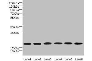 Western blot All lanes: SPATA19 antibody at 1 μg/mL Lane 1: MCF-7 whole cell lysate Lane 2: Hela whole cell lysate Lane 3: HepG2 whole cell lysate Lane 4: MDA-MB-231 whole cell lysate Lane 5: A549 whole cell lysate Lane 6: Mouse liver tissue Secondary Goat polyclonal to rabbit IgG at 1/10000 dilution Predicted band size: 20 kDa Observed band size: 20 kDa (SPATA19 anticorps  (AA 25-167))