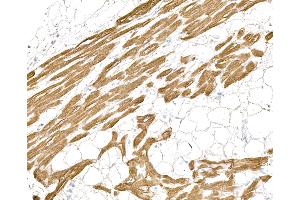 Immunohistochemistry (IHC) image for anti-Myosin, Light Chain 1, Alkali, Skeletal, Fast (MYL1) (Light Chain) antibody (ABIN7795614)