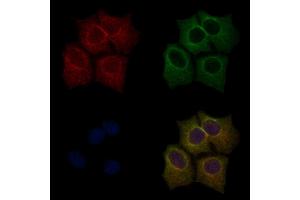 ABIN6255701 and ABIN6267554 staining HepG2 cells(30 min of 4uM Forskolin treatment) by IF/ICC. (LIM Domain Kinase 1 anticorps  (pThr508))