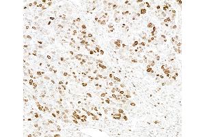 anti-Bromodomain PHD Finger Transcription Factor (BPTF) (AA 1350-1400) antibody